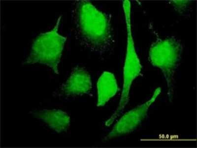 Immunocytochemistry/ Immunofluorescence: Axotrophin Antibody (2B9) [H00064844-M01]