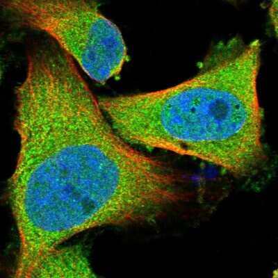 Immunocytochemistry/ Immunofluorescence: Axotrophin Antibody [NBP1-90056]
