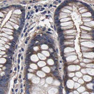 Immunohistochemistry-Paraffin: Axotrophin Antibody [NBP1-90056]