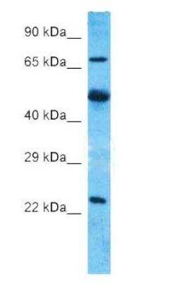 Western Blot: Axotrophin Antibody [NBP2-76664]