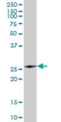 Western Blot: Azurocidin/CAP37/HBP Antibody [H00000566-B01P]