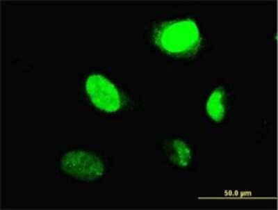 Immunocytochemistry/ Immunofluorescence: B-Myb Antibody (1C7) [H00004605-M02]