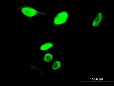 Immunocytochemistry/ Immunofluorescence: B-Myb Antibody (5G5) [H00004605-M03]