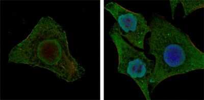 Immunohistochemistry-Paraffin: B-Raf Antibody (1H12) - BSA Free [NBP1-47433]