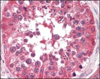 Immunohistochemistry-Paraffin: B-Raf Antibody (1H12) - BSA Free [NBP1-47433]