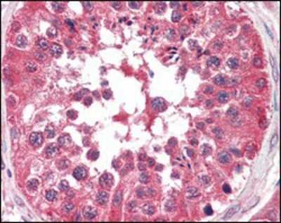 Immunohistochemistry-Paraffin: B-Raf Antibody (1H12F1) - BSA Free [NBP1-47555]