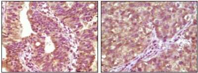 Immunohistochemistry-Paraffin: B-Raf Antibody (1H12F1) - BSA Free [NBP1-47555]