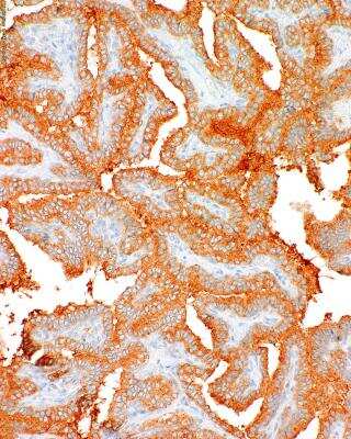 Immunohistochemistry-Paraffin: B-Raf Antibody (IHC600) - V600-E Mutation [NBP3-00517]