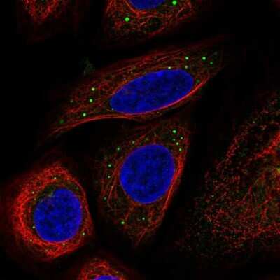 Immunocytochemistry/ Immunofluorescence: B-Raf Antibody [NBP2-58818]