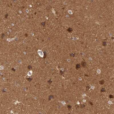 Immunohistochemistry-Paraffin: B-Raf Antibody [NBP1-89942]