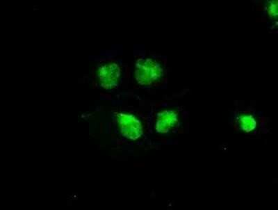 Immunocytochemistry/ Immunofluorescence: B-Raf Antibody (OTI5A9) - Azide and BSA Free [NBP2-70260]