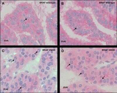 Immunohistochemistry: B-Raf Antibody (OTI5A9) - Azide and BSA Free [NBP2-70260]