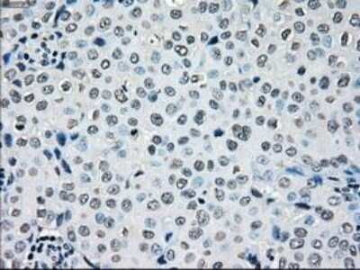 Immunohistochemistry: B-Raf Antibody (OTI5A9) - Azide and BSA Free [NBP2-70260]