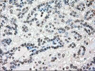 Immunohistochemistry: B-Raf Antibody (OTI5A9) - Azide and BSA Free [NBP2-70260]