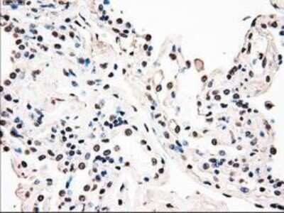 Immunohistochemistry: B-Raf Antibody (OTI5A9) - Azide and BSA Free [NBP2-70260]