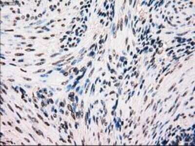 Immunohistochemistry: B-Raf Antibody (OTI5A9) - Azide and BSA Free [NBP2-70260]