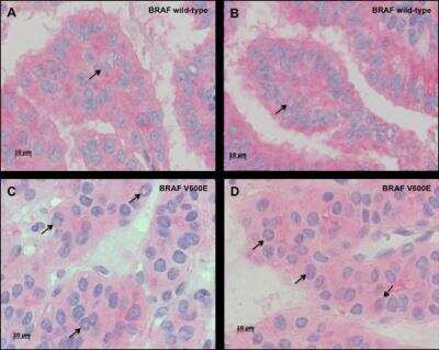 Immunohistochemistry: B-Raf Antibody (OTI5A9) [NBP1-47668]