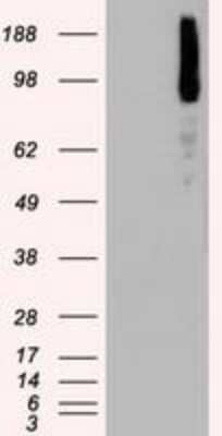 Western Blot: B-Raf Antibody (OTI5A9) [NBP1-47668]