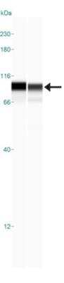 Simple Western: B-Raf Antibody [NBP1-89942]