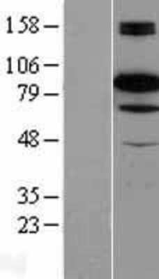 Western Blot: B-Raf Overexpression Lysate [NBL1-08021]