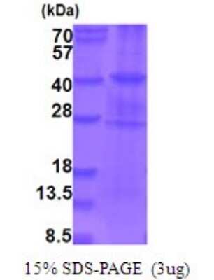SDS-PAGE: Recombinant Human B-Raf His Protein [NBP2-51931]