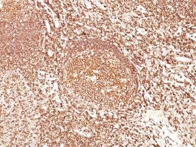 Immunohistochemistry-Paraffin: B220/CD45R Antibody (F10-89-4) - Azide and BSA Free [NBP2-54455]