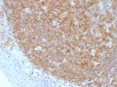 Immunohistochemistry-Paraffin: B220/CD45R Antibody (F10-89-4) [NBP2-53175]