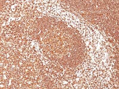 Immunohistochemistry-Paraffin: B220/CD45R Antibody (PTPRC/1461) - Azide and BSA Free [NBP2-54464]