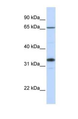 Western Blot: B3GALT1 Antibody [NBP1-69328]