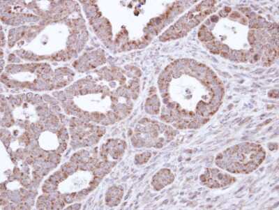 Immunohistochemistry-Paraffin: B3GALTL Antibody [NBP1-32787]