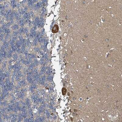 Immunohistochemistry-Paraffin: beta-1,3-Glucuronyltransferase 3/B3GAT3 Antibody [NBP2-33611]