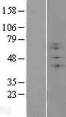 Western Blot: Beta-1,3-N-Acetylglucosaminyltransferase 2/B3GNT2 Overexpression Lysate [NBL1-07884]
