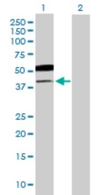 Western Blot: B3GNT5 Antibody [H00084002-B01P]