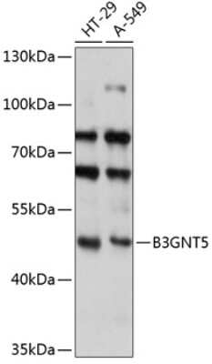Western Blot: B3GNT5 AntibodyAzide and BSA Free [NBP2-92163]
