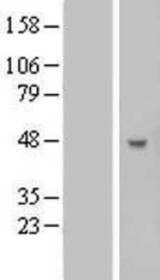 Western Blot: B3GNT5 Overexpression Lysate [NBL1-07887]