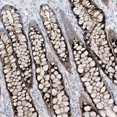 Immunohistochemistry-Paraffin: B3GNT7 Antibody [NBP1-88659]
