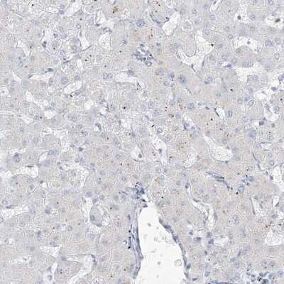 Immunohistochemistry-Paraffin: B3GNT7 Antibody [NBP1-88659]
