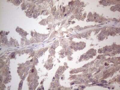 Immunohistochemistry: B4GALT4 Antibody (OTI8B6) [NBP2-46562]