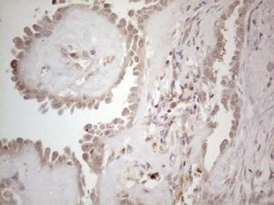 Immunohistochemistry: B4GALT4 Antibody (OTI8B6) [NBP2-46562]