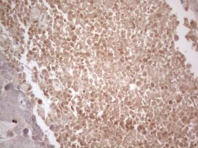 Immunohistochemistry: B4GALT4 Antibody (OTI8B6) [NBP2-46562]