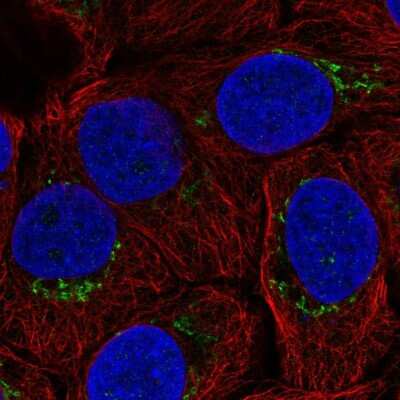 Immunocytochemistry/ Immunofluorescence: B4GALT4 Antibody [NBP2-57489]
