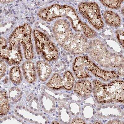 Immunohistochemistry-Paraffin: B4GALT4 Antibody [NBP2-14343]