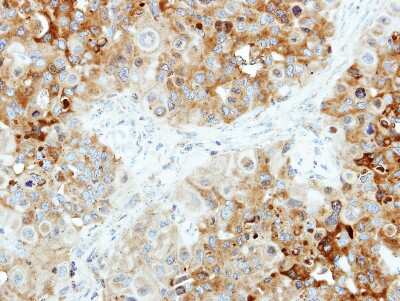 Immunohistochemistry-Paraffin: B4GALT4 Antibody [NBP2-15534]