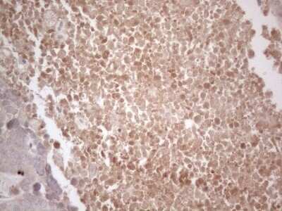 Immunohistochemistry: B4GALT4 Antibody (OTI8B6) - Azide and BSA Free [NBP2-71385]