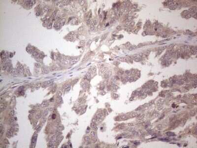 Immunohistochemistry: B4GALT4 Antibody (OTI8B6) - Azide and BSA Free [NBP2-71385]