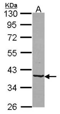Western Blot: B4GALT4 Antibody [NBP2-15534]