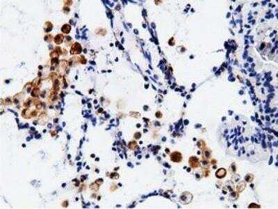 Immunohistochemistry-Paraffin: B7-1/CD80 Antibody (OTI2E5) [NBP2-02905]