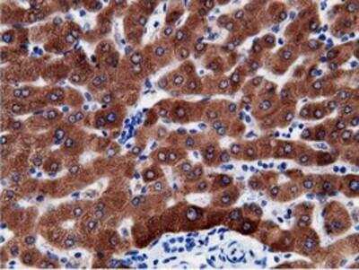 Immunohistochemistry-Paraffin: B7-1/CD80 Antibody (OTI2E5) [NBP2-02905]
