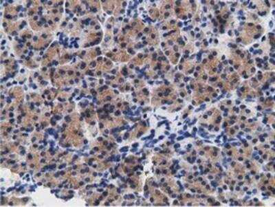 Immunohistochemistry-Paraffin: B7-1/CD80 Antibody (OTI2E5) [NBP2-02905]