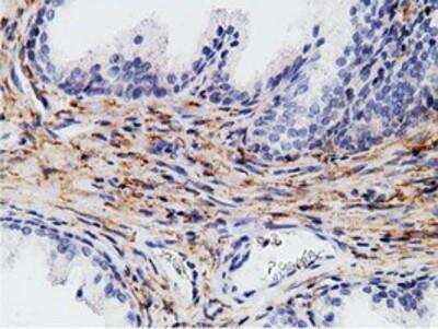 Immunohistochemistry-Paraffin: B7-1/CD80 Antibody (OTI2E5) [NBP2-02905]